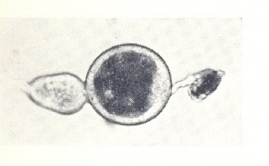 G pallidipes ovariole 2